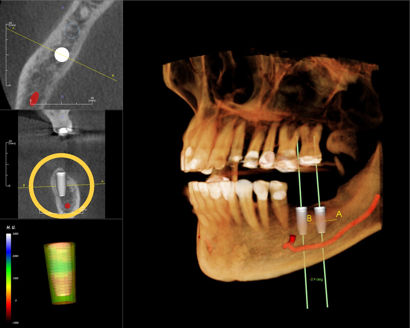 Chụp X-quang / CBCT 3D